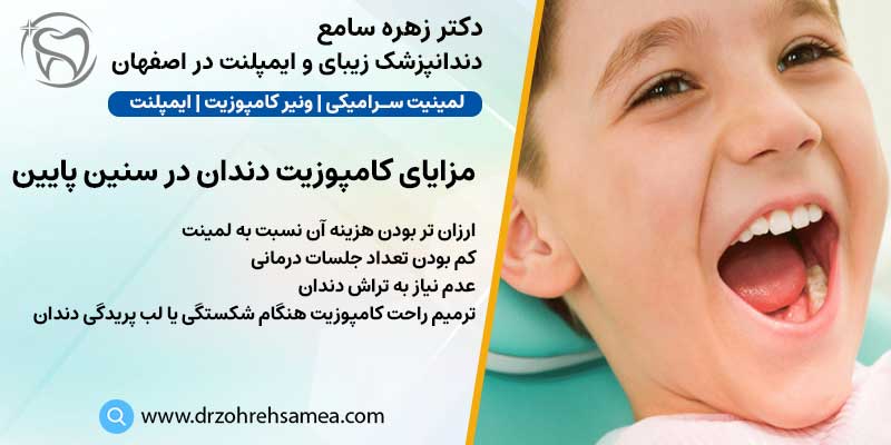 مزایای ونیر کامپوزیت در سنسن پایین | دکتر زهره سامع دندانپزشک زیبایی در اصفهان