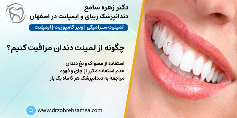 چگونه از لمینت دندان مراقبت کنیم | دکتر زهره سامع دندانپزشک زیبایی و ایمپلنت در اصفهان